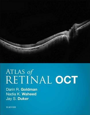Download Atlas of Retinal Oct E-Book: Optical Coherence Tomography - Darin Goldman | PDF